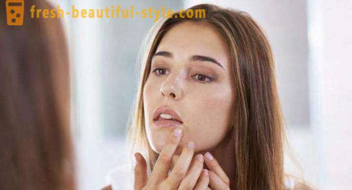 Waarom hebben veel mensen hebben puistjes op je gezicht? Oorzaken en behandelingsmethoden