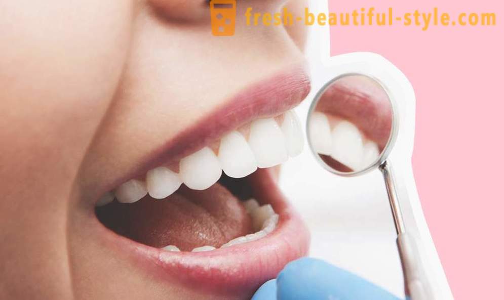 4 vragen over tandheelkundige implantaten