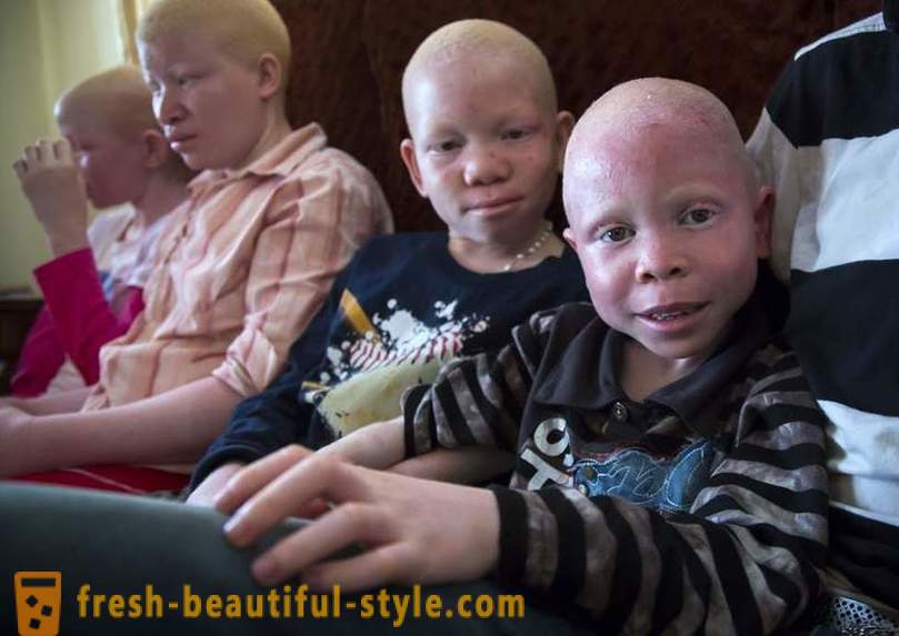 De tragische geschiedenis van de Tanzaniaanse albino's