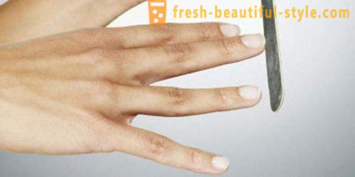 Witte vlekken op de nagels van de vingers: de oorzaken en behandeling