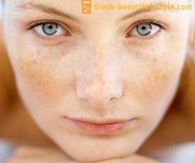 Waarom schilferige huid op het gezicht? Probleem gezichtshuid