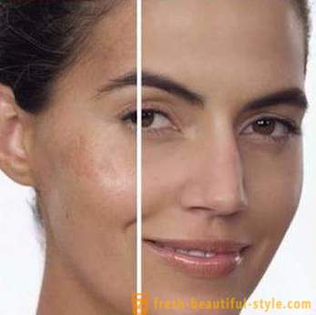 Whitening Cream van ouderdomsvlekken op het gezicht: de belangrijkste soorten beoordelingen