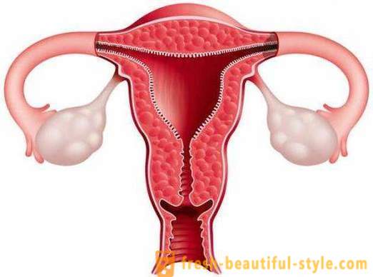 Hoe het endometrium te verhogen