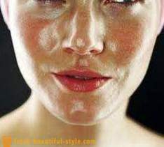 Vette huid gezicht: wat te doen om te gaan met het probleem?