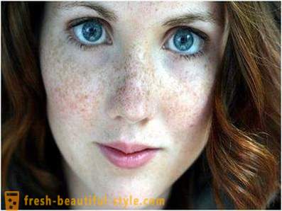 Zorgen voor hun schoonheid en jeugd: zorgt voor de pigmentatie op het gezicht